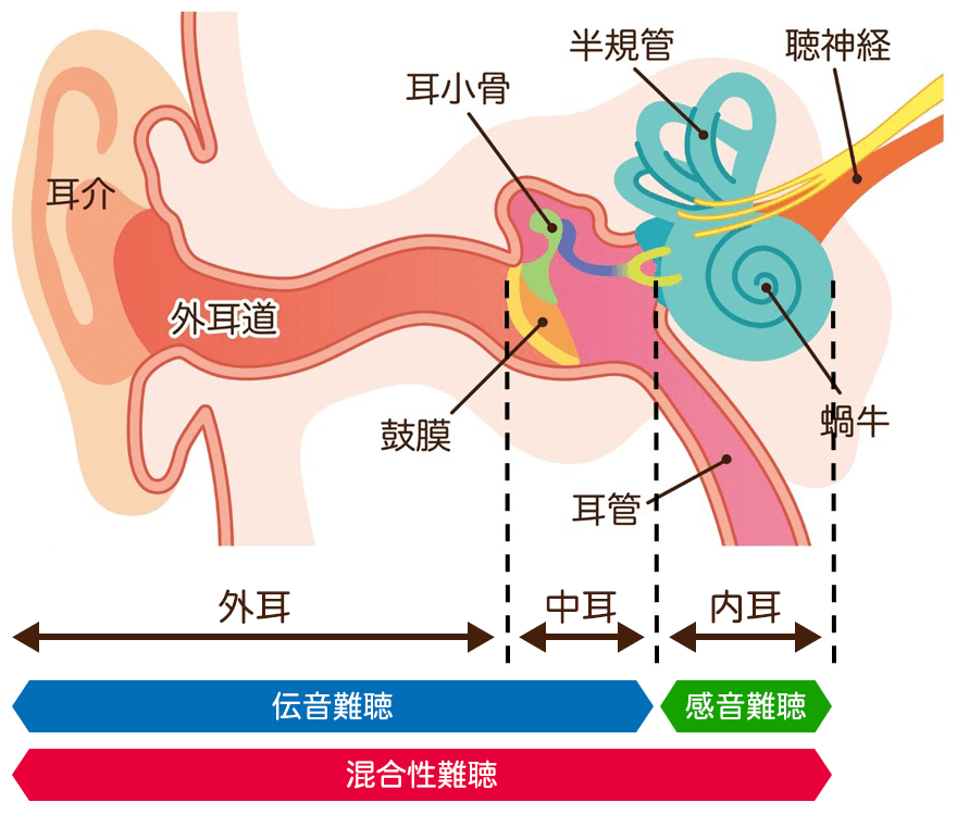 聞こえの仕組み。あらゆる音は空気中を移動する目に見えない振動。風が吹く、鳥が鳴く、それを音源とした空気の波が、集音器である耳介を通って耳穴に入り、奥にある鼓膜や耳小骨で振動は大きくなります。そして蝸牛の中で振動音は電気信号に変換され、どんな高さ（周波数）がどんな強さか分析し分類され、聴神経に運ばれ、最後に脳が記憶を照合しそれが何の音かを決定します。この過程を経てはじめて”音”が聴こえます。