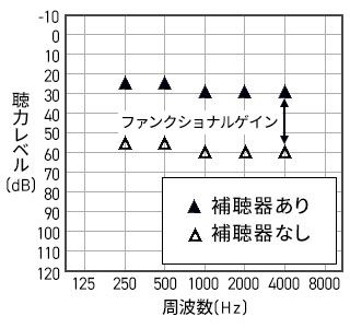 装用閾値測定。まず補聴器をつけていない状態での聞こえを測定します。音がかすかでも聞こえた時に応答ボタンを押して頂きます。結果は△で表示します。この△が下にあるほど、聞きにくいということを表しています。次に補聴器を着けて同様の測定を行います。結果は▲で表示します。表は縦軸が聴力レベル、横軸が周波数です。この表で見ますと、1000Hzでは補聴器なしで60dBの大きさで聞こえていたのが、補聴器ありでは30dBの大きさでも聞こえるよう改善しています。この差30dBをファンクショナルゲインと言い、補聴器の効果を表します。
